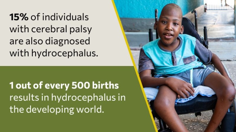 15% of individuals with cerebral palsy 
are also diagnosed with hydrocephalus.

1 out of every 500 births results in hydrocephalus in the developing world.